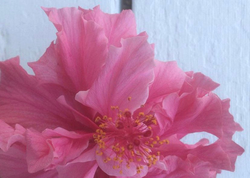 Community Story: Labiaplasty